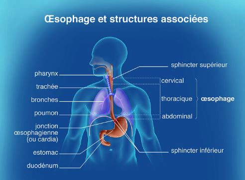 Cancer Oesophage Irfc